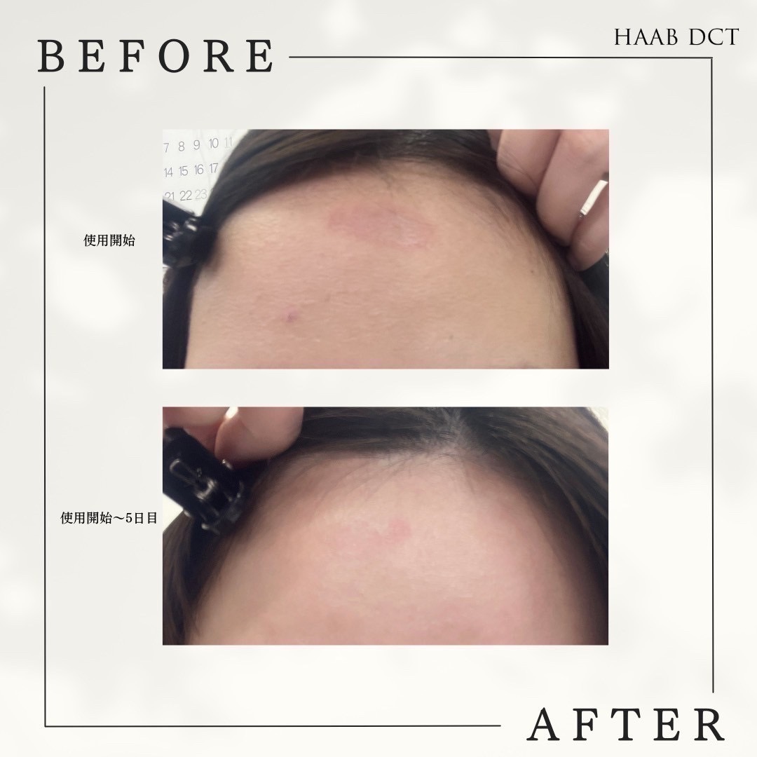 HAAB SKIN プレミアムエクソソーム｜有限会社アイエヌジー