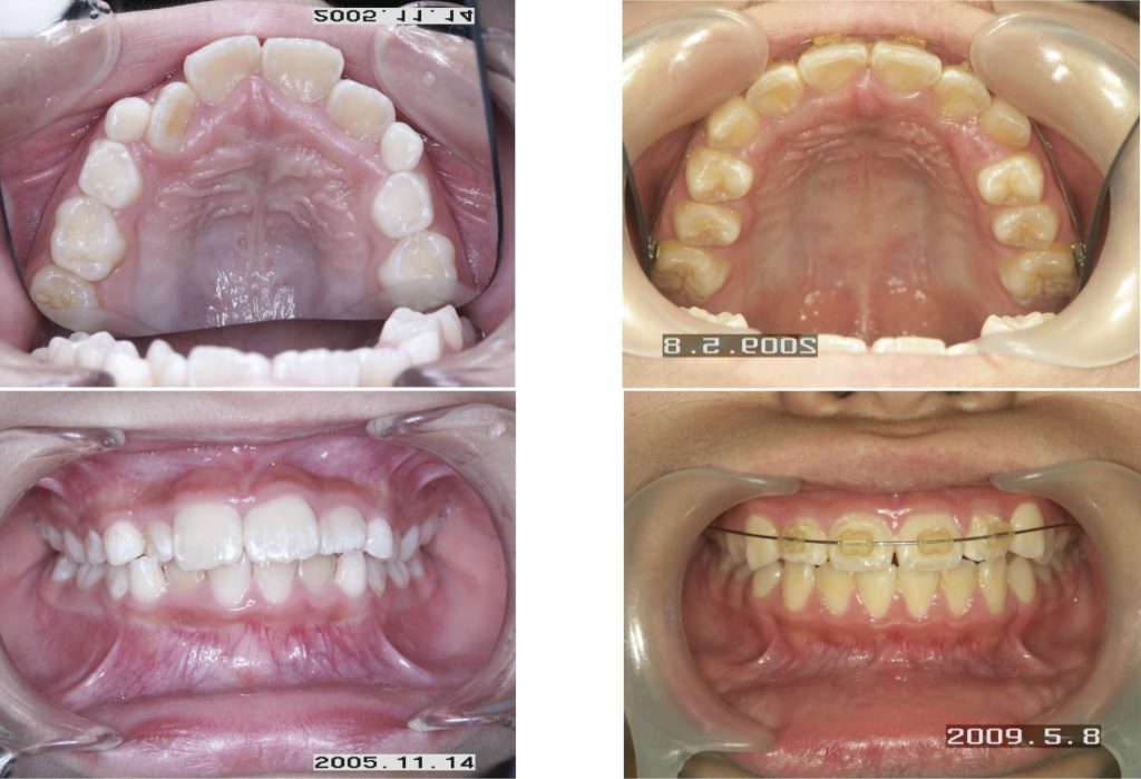 非抜歯矯正治療を実践するために album 256 | 石井歯科矯正歯科医院