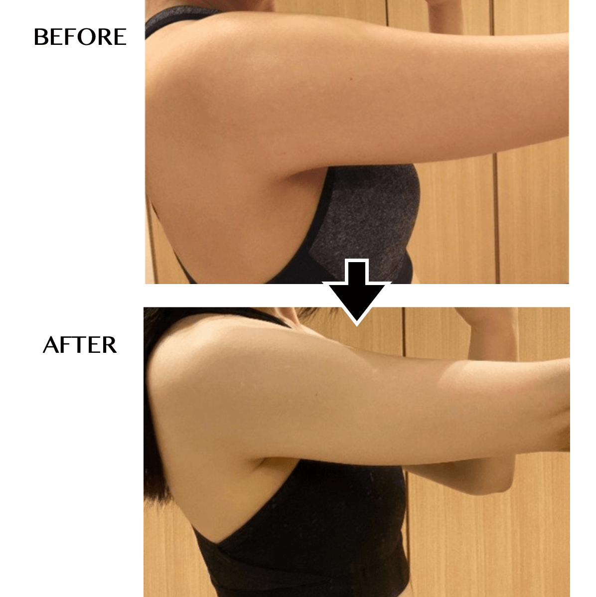 CELLZERO BAG | 「じぶんdeエステ」オンラインショップ【公式】