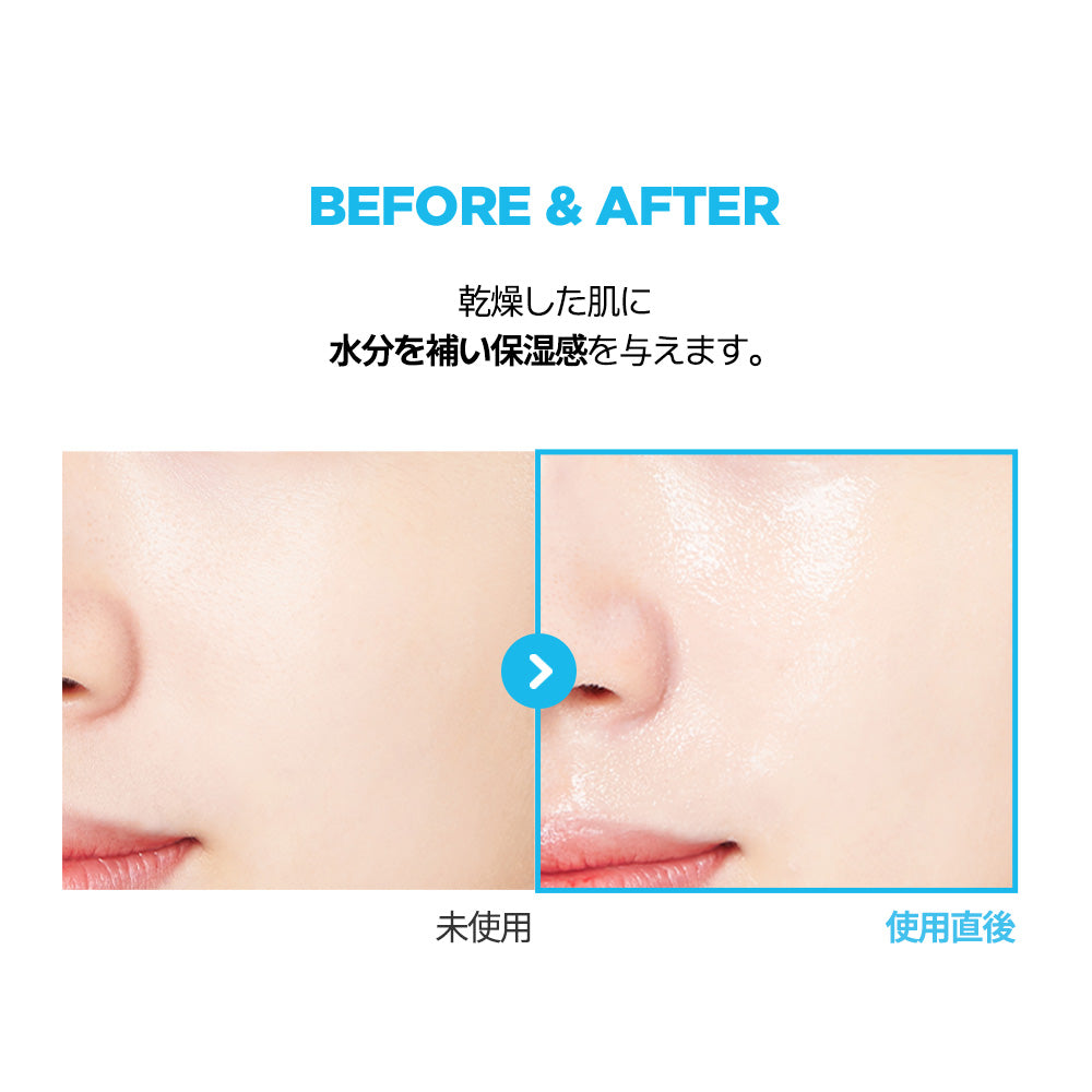 JMsolution公式店 】ウォータールミナス S.O.Sリンガーマスクプラス