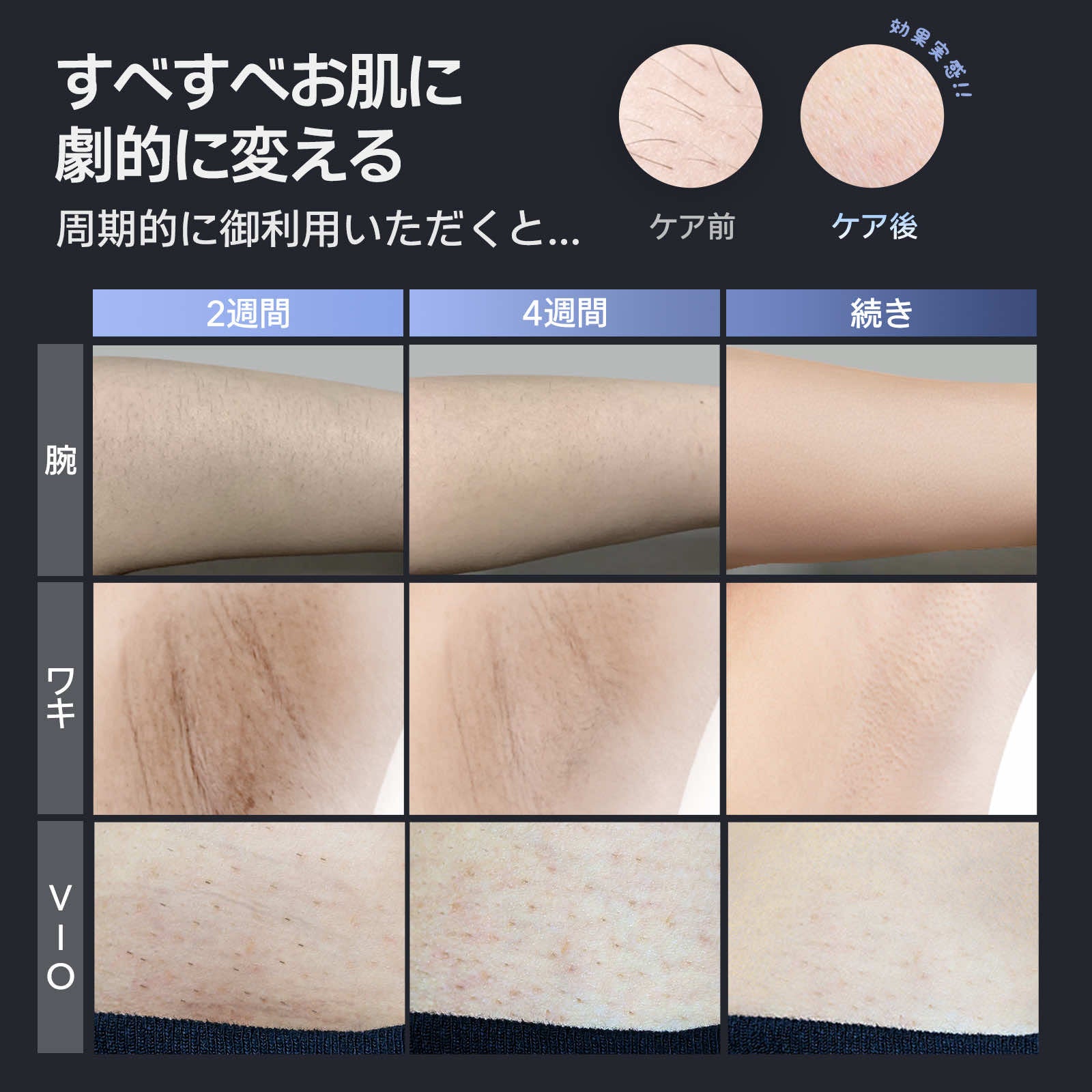 公式】Ulike Air 2 Men IPL光美容器｜脱毛器・家庭用脱毛器・メンズ