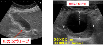 エコー検査について｜ 立川で内科・外科・外来診療と救急医療を提供