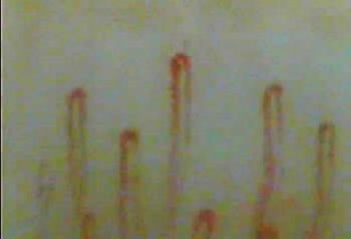 毛細血管スコープSC-10 – あっと株式会社