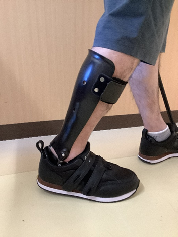 タマラックジョイント付きプラスチック短下肢装具 - 国分寺病院