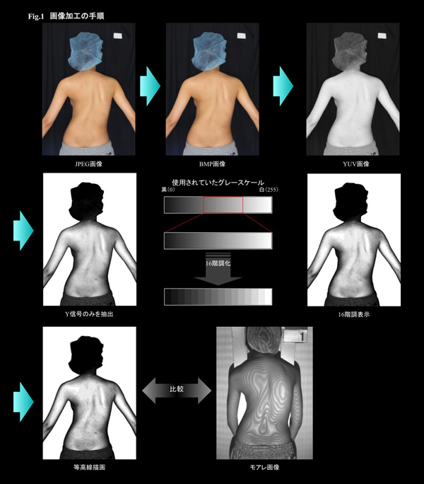 研究紹介│医療関係者の方へ│北里大学医学部 整形外科学