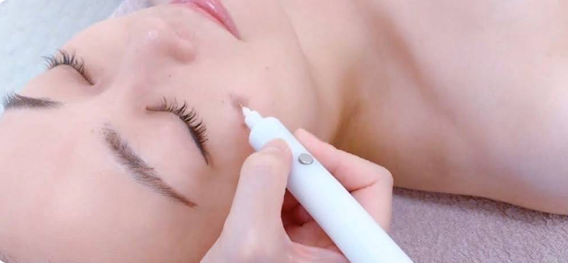 Soltのシミケア- 肌に優しい低周波でシミを根本から改善 | 美肌脱毛