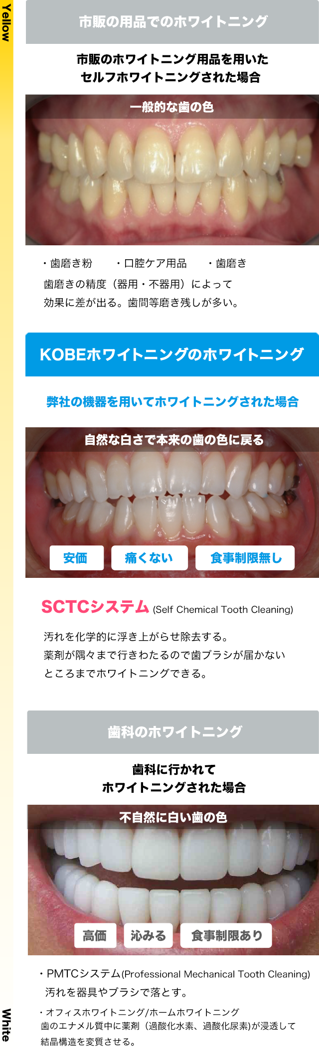 KOBEホワイトニングのセルフホワイトニング┃KOBEホワイトニング株式会社