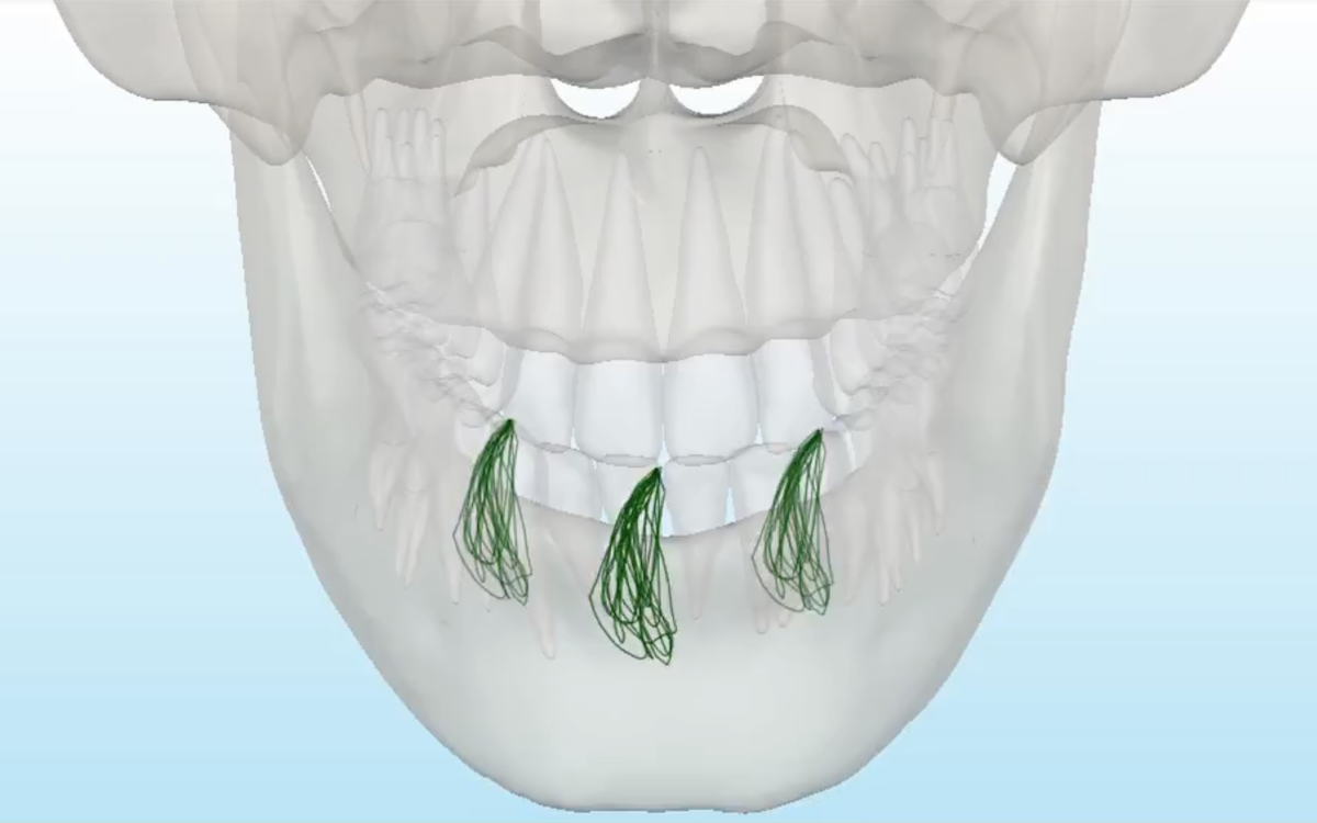 顎関節症-コンピューター診断と噛み合わせ調整 | 高坂デンタルオフィス