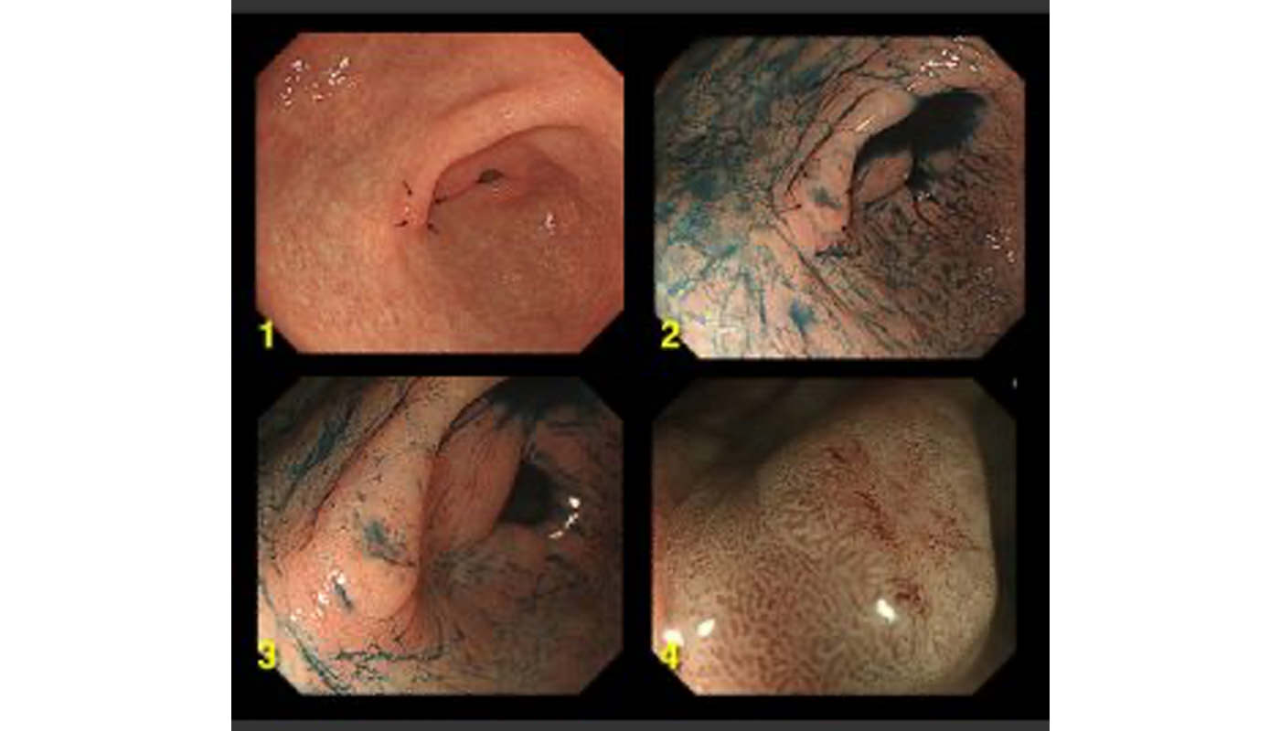 胃 – kozaki-clinic