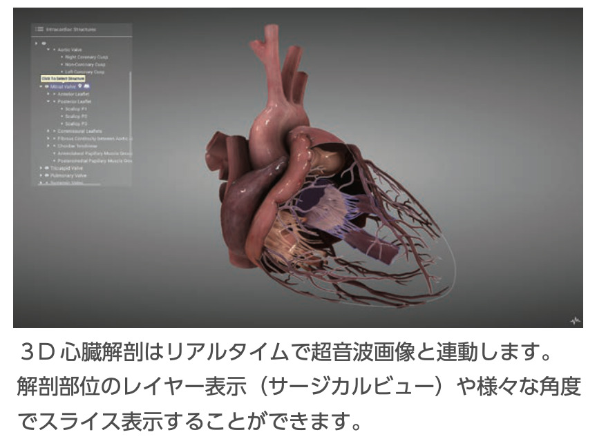 心エコー,経食道心エコー