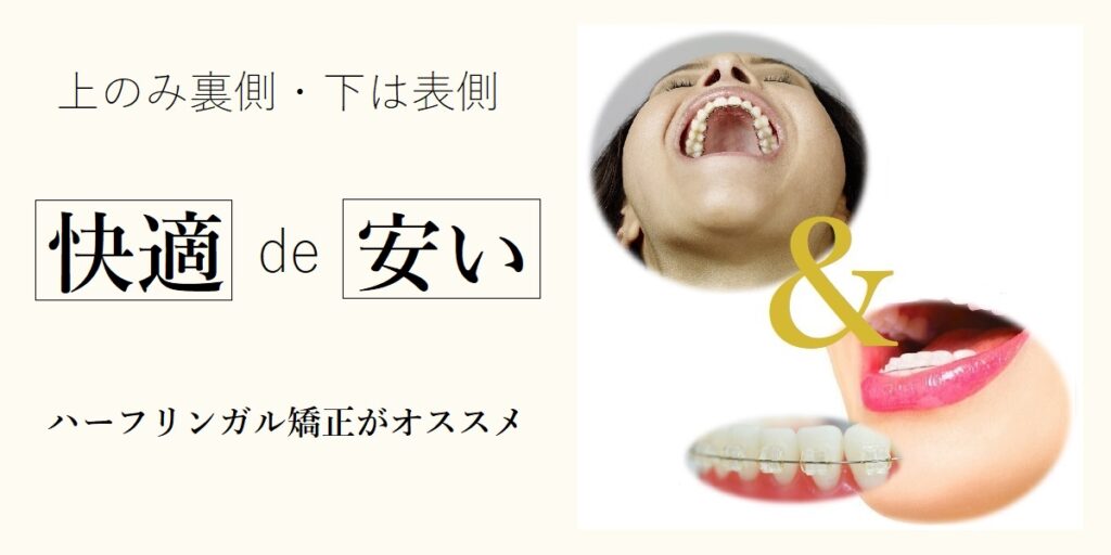 裏側矯正（リンガル矯正） - 矯正歯科が渋谷で安いとおすすめTBDC東京