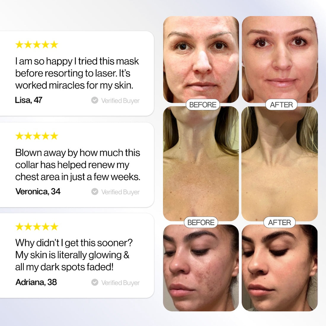 Glotech™ Pro Red Light Therapy Mask | LED Esthetics