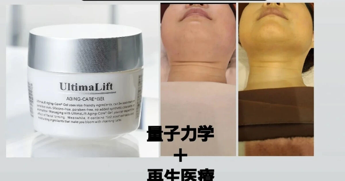 プラチナ量子矯正ジェル（アルティマリフト）の施術への使用、及