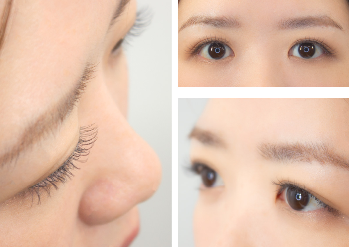 脱毛中 つけまつげ、抗がん剤 まつげケア | つけまつげ グルーセット