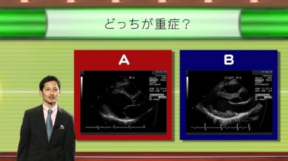 Amazon.co.jp: Dr.香坂の循環器診療 最前線(1)/ケアネットDVD : 香坂