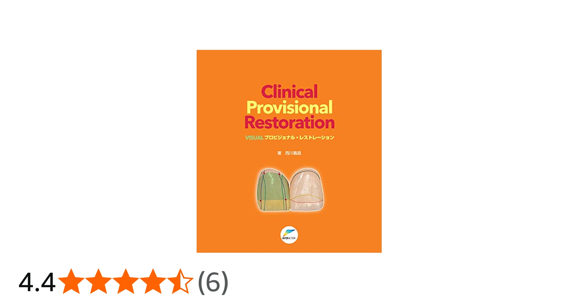 Clinical Provisional Restoration: VISUALプロビジョナル・レスト