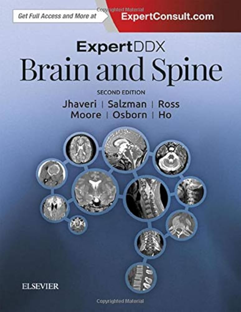 ExpertDDx: Brain and Spine: 9780323443081: Medicine & Health