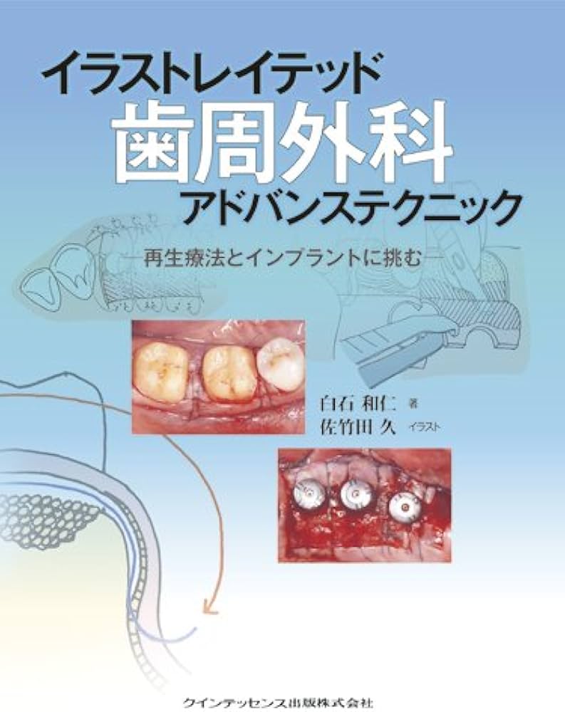 イラストレイテッド 歯周外科アドバンステクニック | 白石 和仁, 佐