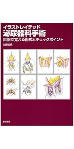 Amazon.co.jp: イラストレイテッド泌尿器科手術 (第2集) : 加藤 晴朗: 本