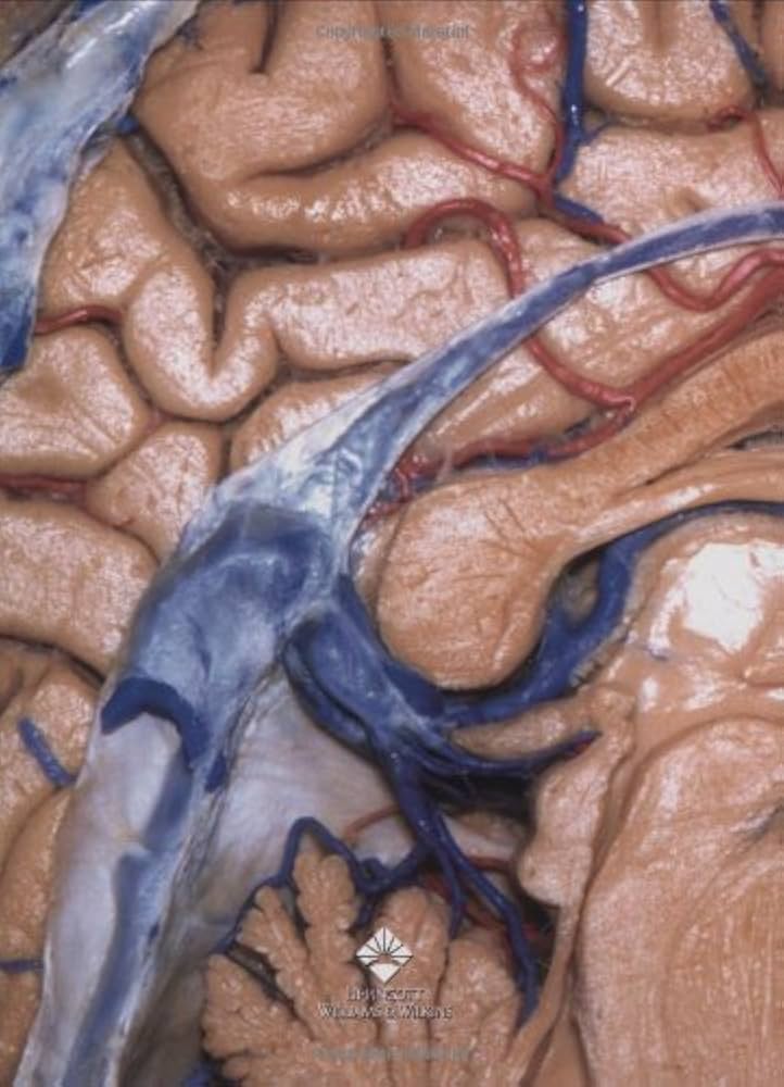 Amazon | Rhoton's Cranial Anatomy and Surgical Approaches | Rhoton