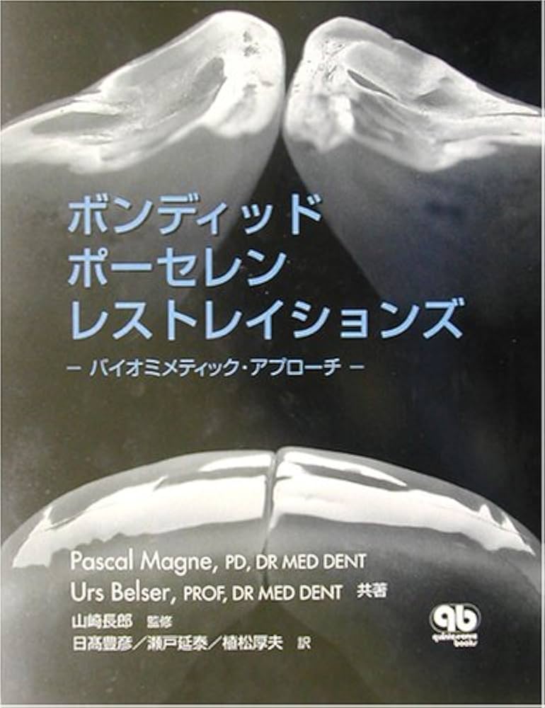 ボンディッドポーセレンレストレイションズ: バイオミメティック