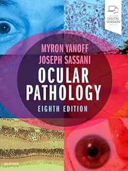 Ocular Pathology: 9780323547550: Medicine & Health Science Books