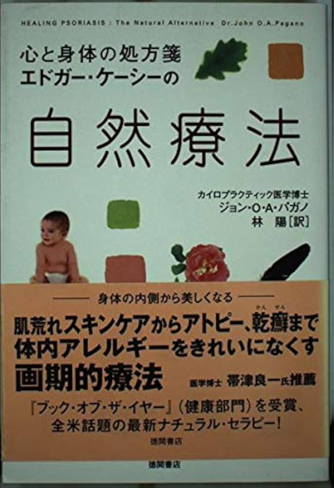 Amazon.co.jp: エドガー・ケーシーの自然療法: 心と身体の処方箋