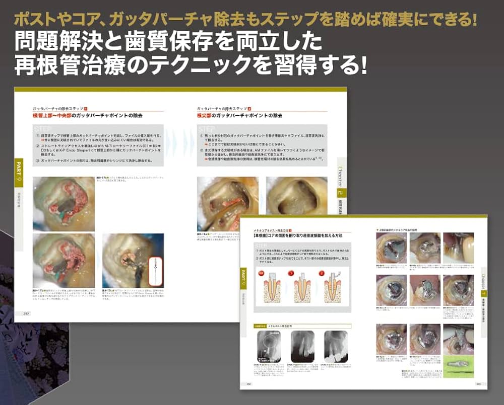 ビジュアル歯内療法学: 生物学的コンセプトとテクニックのすべて