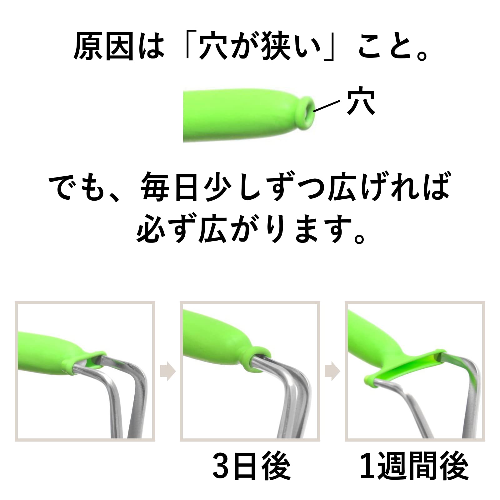 Amazon | キトー君 真性専用。仮性の方は使えません。 (DX) | キトー君