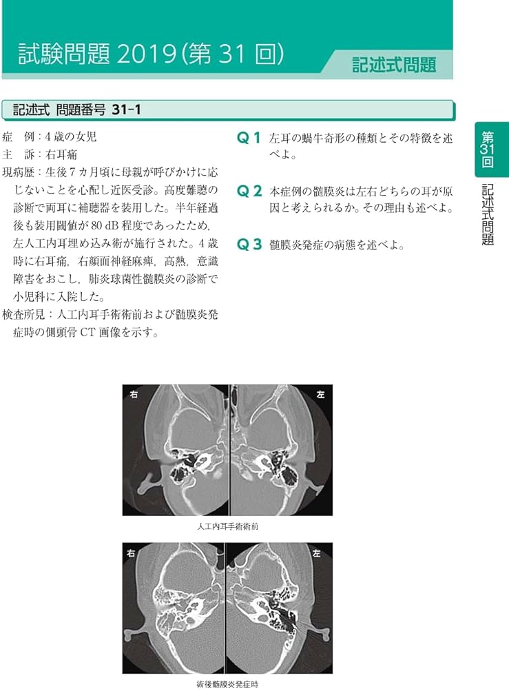 耳鼻咽喉科専門医認定試験 2019~2023 問題と解答 | 一般社団法人日本