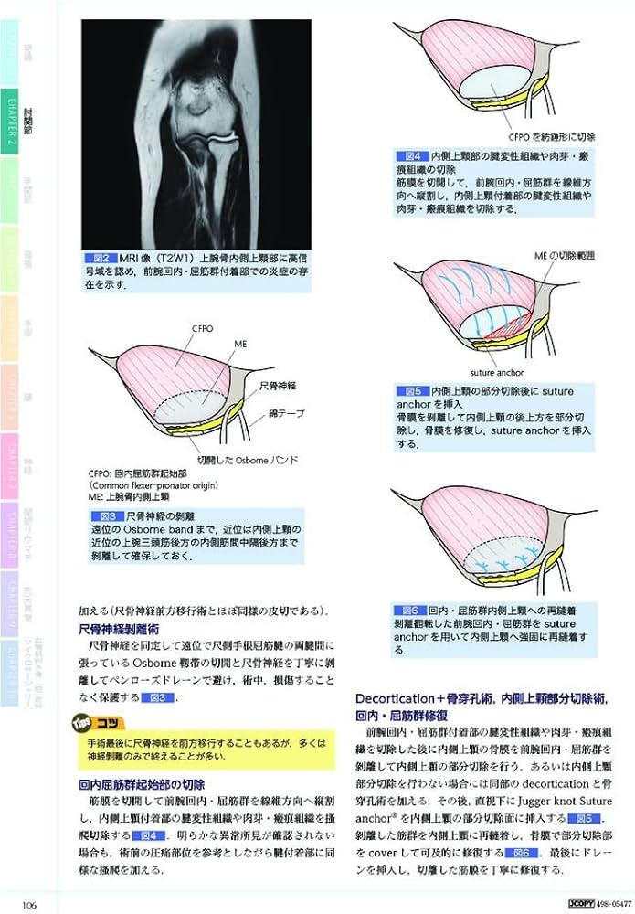 手の外科―私のアプローチ 第2版 | 三浪 明男 |本 | 通販 | Amazon
