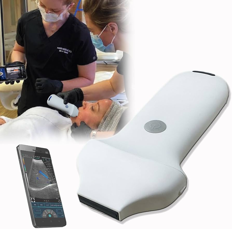 Amazon.com: Handheld Facial Vein Finder Viewer, Face Vein Locator
