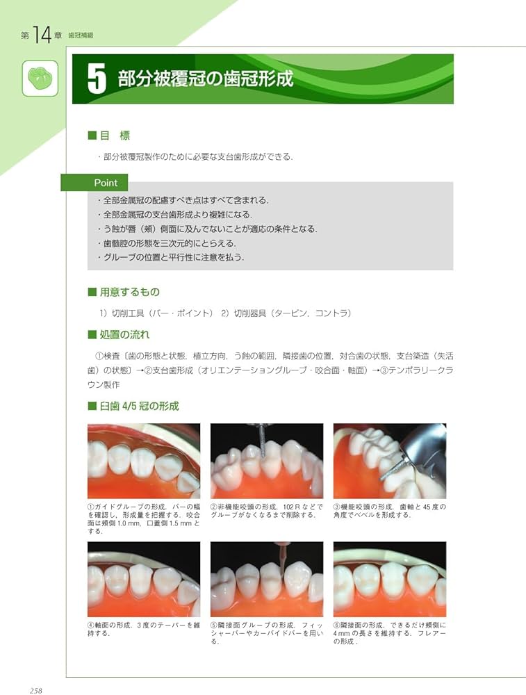 臨床歯科医のための補綴前矯正治療の実際 4874174639 クインテッセンス