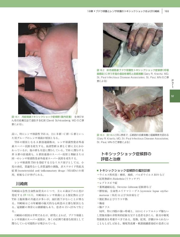 シュロスバーグの臨床感染症学 | David Schlossberg, 岩田健太郎 |本