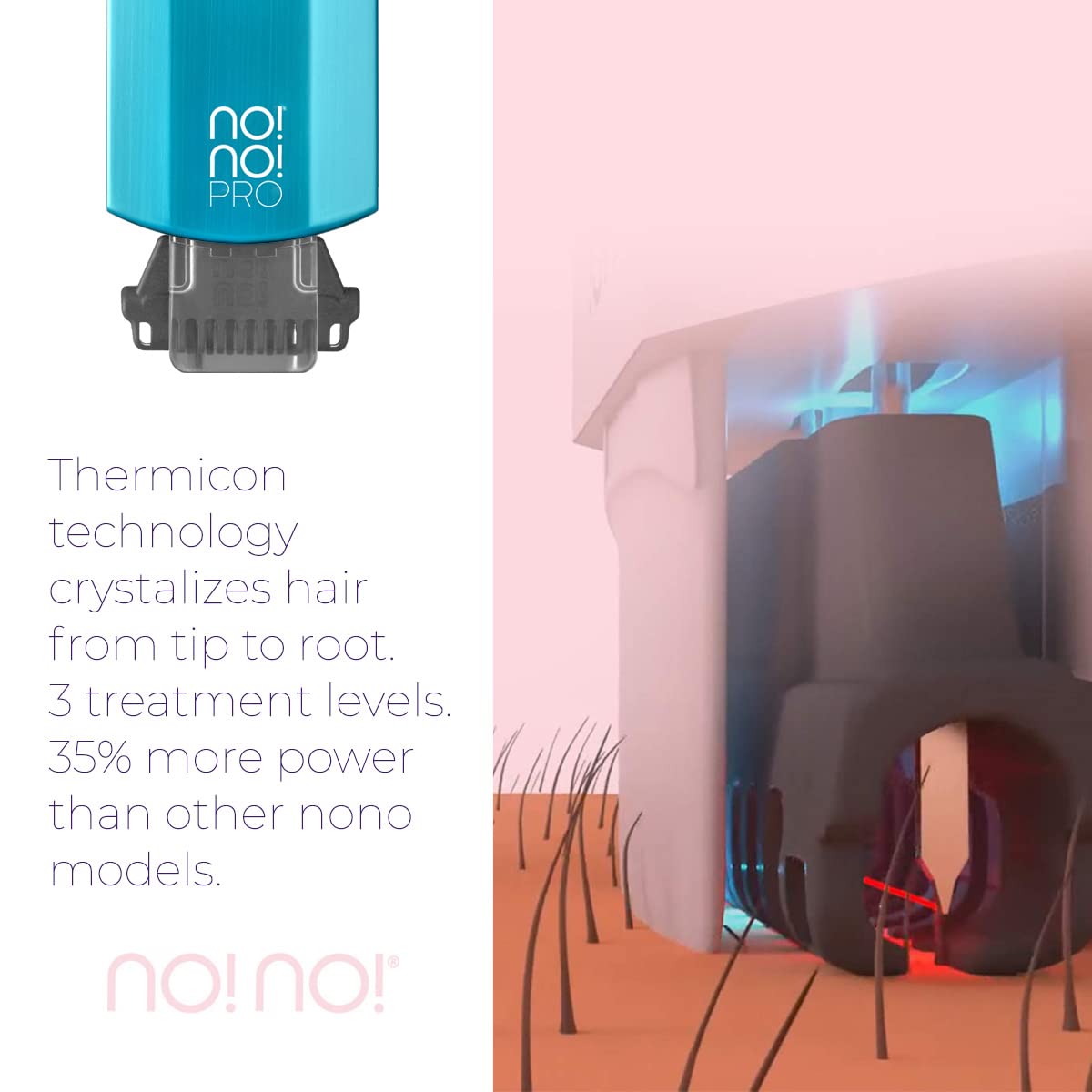 Amazon.com : no!no! Pro Hair Removal Device - Treats All Skin