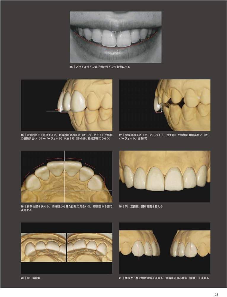 天然歯の形態学 2 | 脇田 太裕 |本 | 通販 | Amazon
