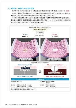 これなら見逃さない！胃X線読影法 虎の巻 改訂版〜シェーマ＋内視鏡像