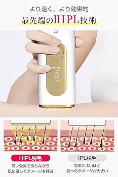 Amazon | Timicon 【2023年夏新版 HIPL光脱毛器】 サロン級 速い 痛く