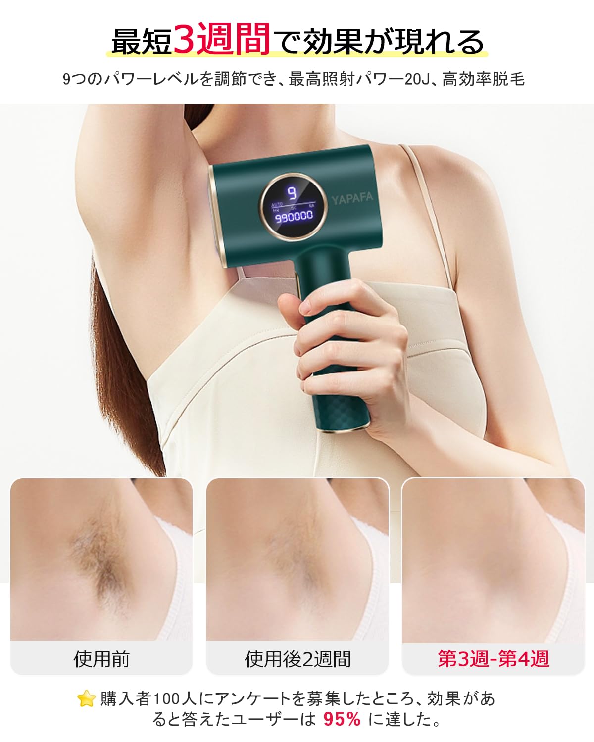 Amazon | YAPAFA 脱毛器 VIO対応 IPL光脱毛器 無痛脱毛器 自働照射 9