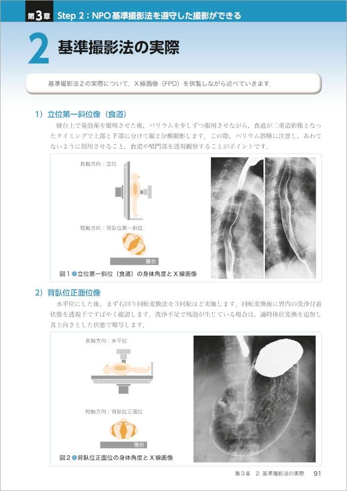 胃癌をしっかり表そう！ 胃X線撮影法 虎の巻〜撮影手技を基本から応用