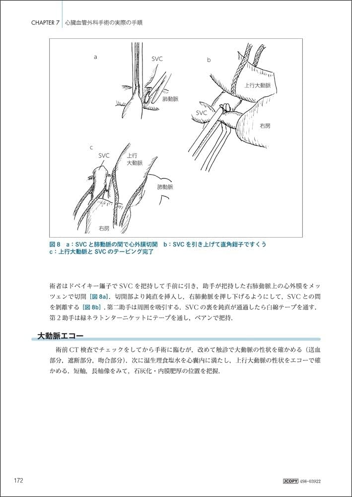 Amazon.co.jp: 心臓血管外科手術虎の巻 : 山口 敦司: Japanese Books
