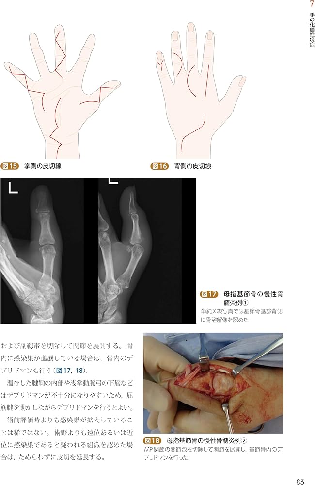Amazon.co.jp: 手外科手術ノート part3：外傷以外の主要疾患治療編