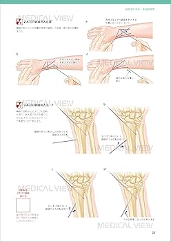 小児の骨折と手術［Web動画付］ (新OS NEXUS) | 大谷 卓也 |本 | 通販