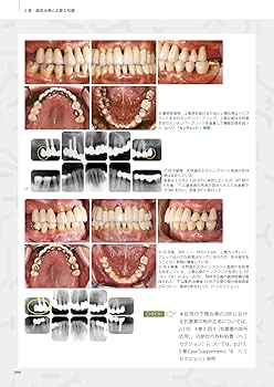 717qiV6QApL._AC_UF350,