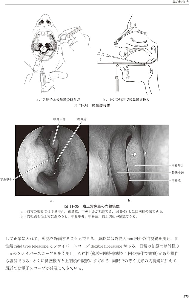 新耳鼻咽喉科学 | 野村 恭也, 加我 君孝, 切替 一郎 |本 | 通販 | Amazon