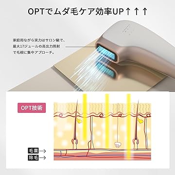 Amazon.co.jp: YOEYOU 脱毛器: U7 脱毛器