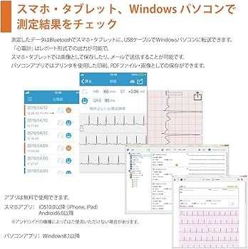 Amazon.co.jp: チェックミーECG アドバンスモデル 携帯型心電計