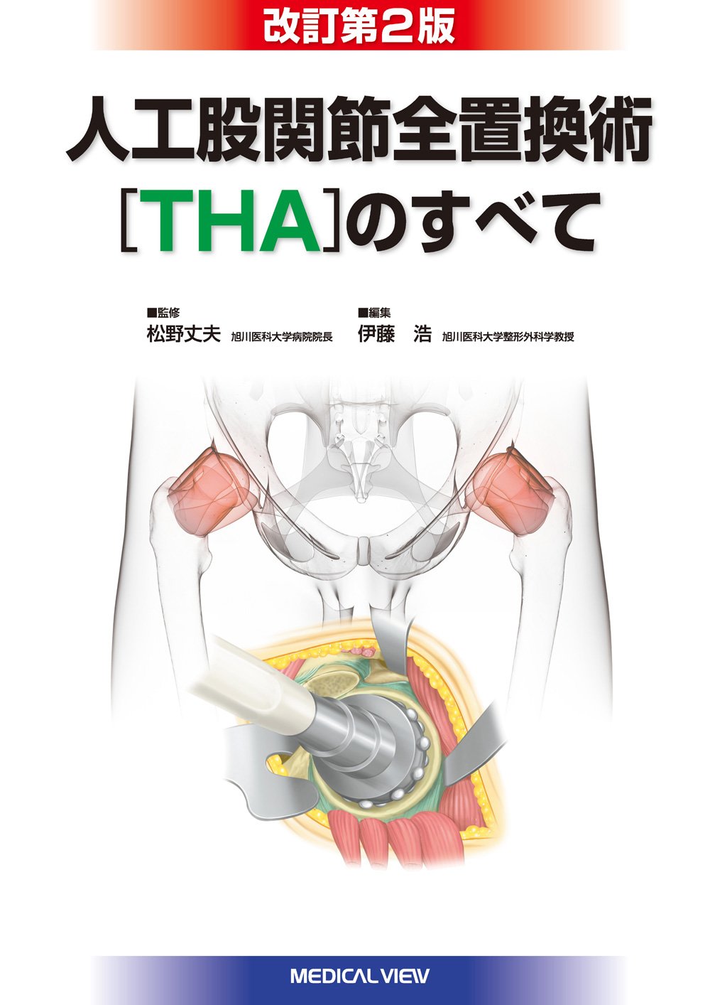 人工股関節全置換術[THA]のすべて | 伊藤 浩 |本 | 通販 | Amazon
