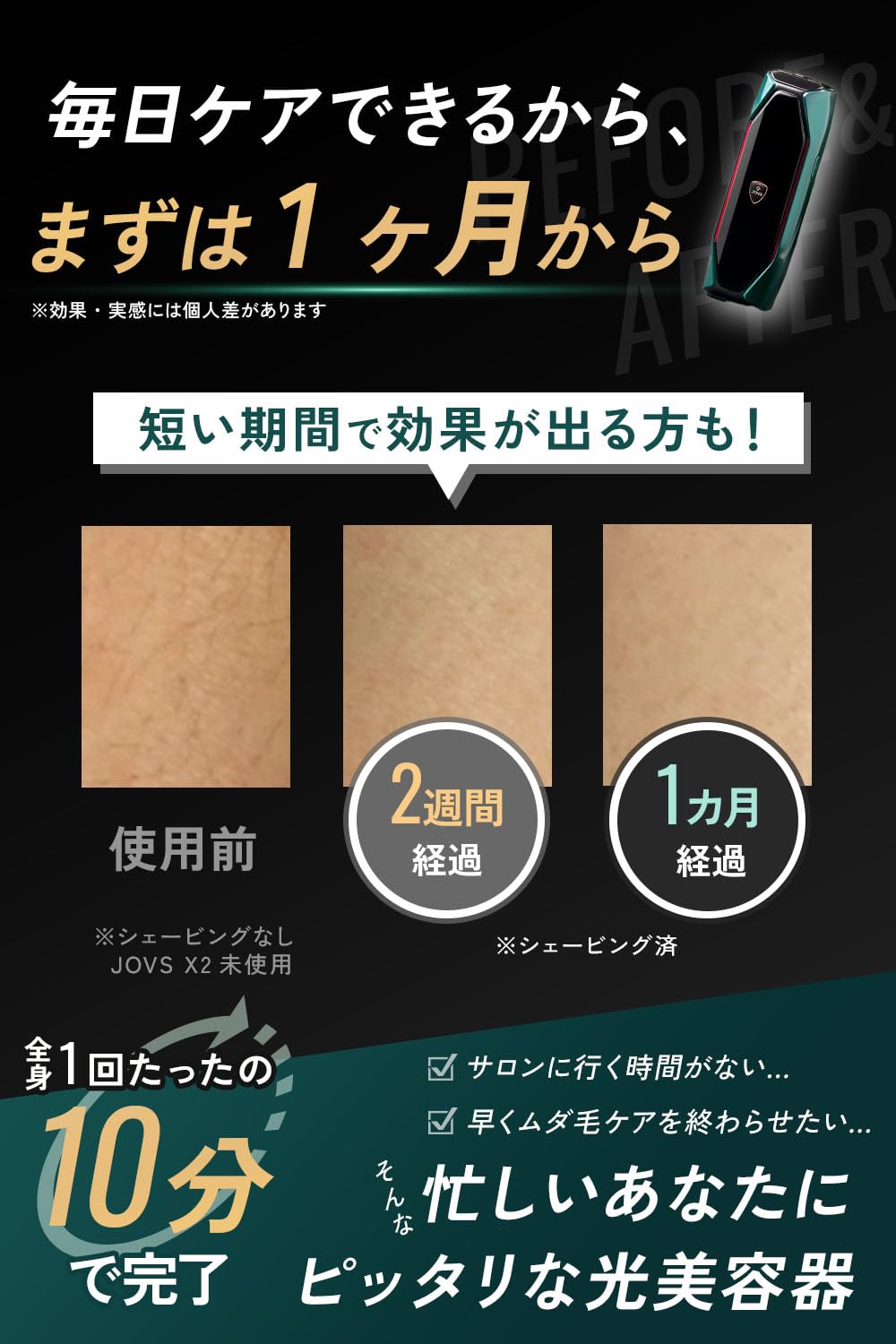 Amazon | JOVS X2 脱毛器 メンズ 髭 レディース vio 全身対応 家庭用(3