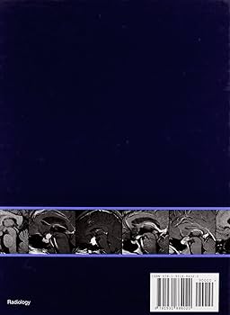 Amazon | EXPERTddx™: Brain and Spine (Expert Differential